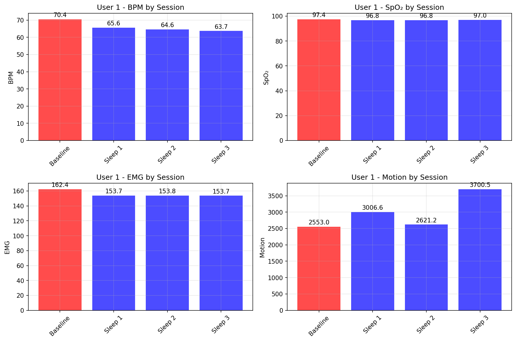 Baseline vs Sessions
