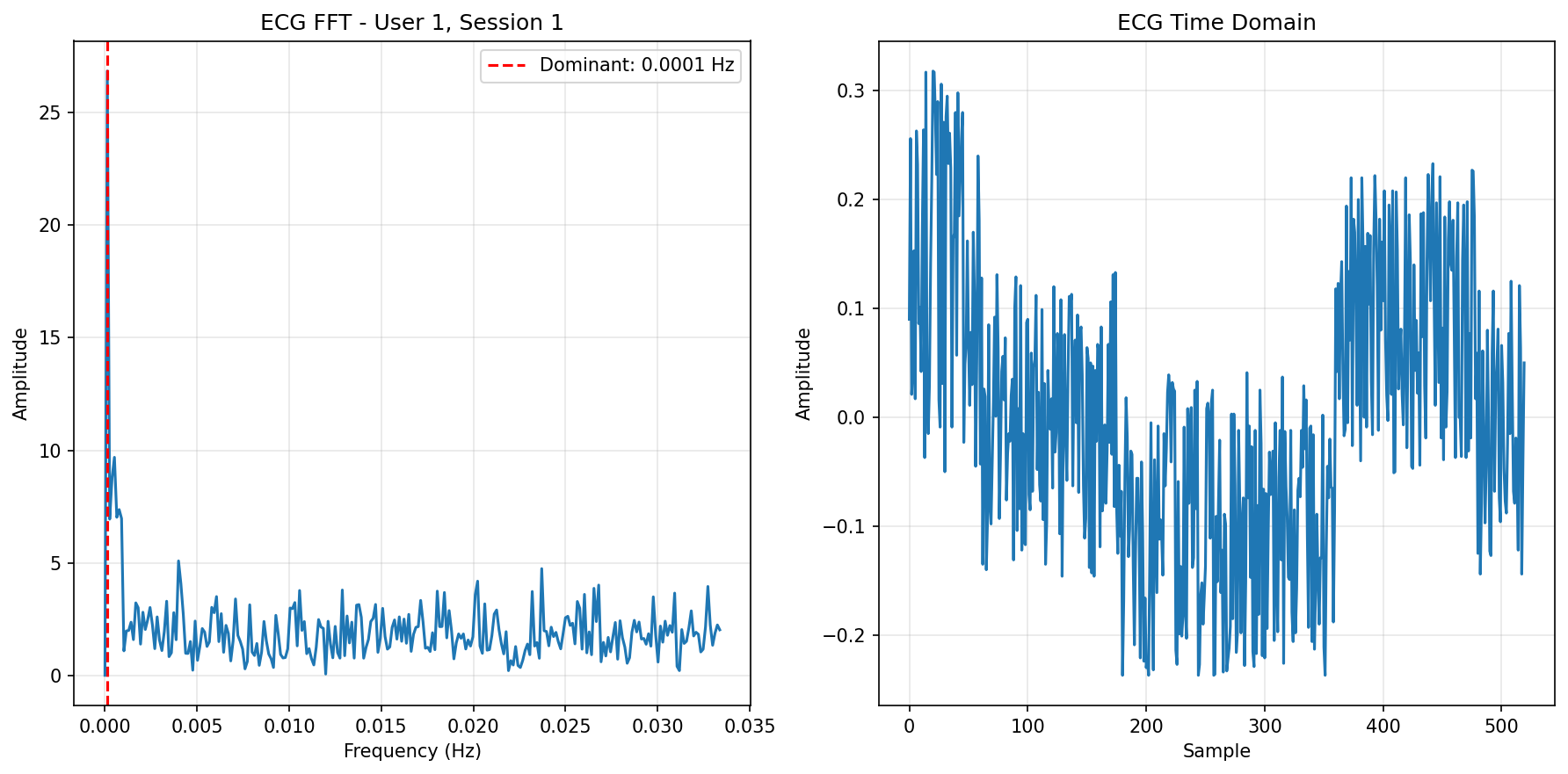 ECG FFT Session 1
