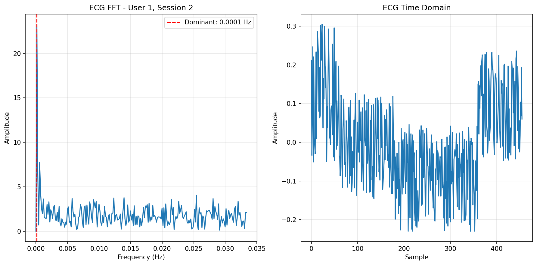 ECG FFT Session 2