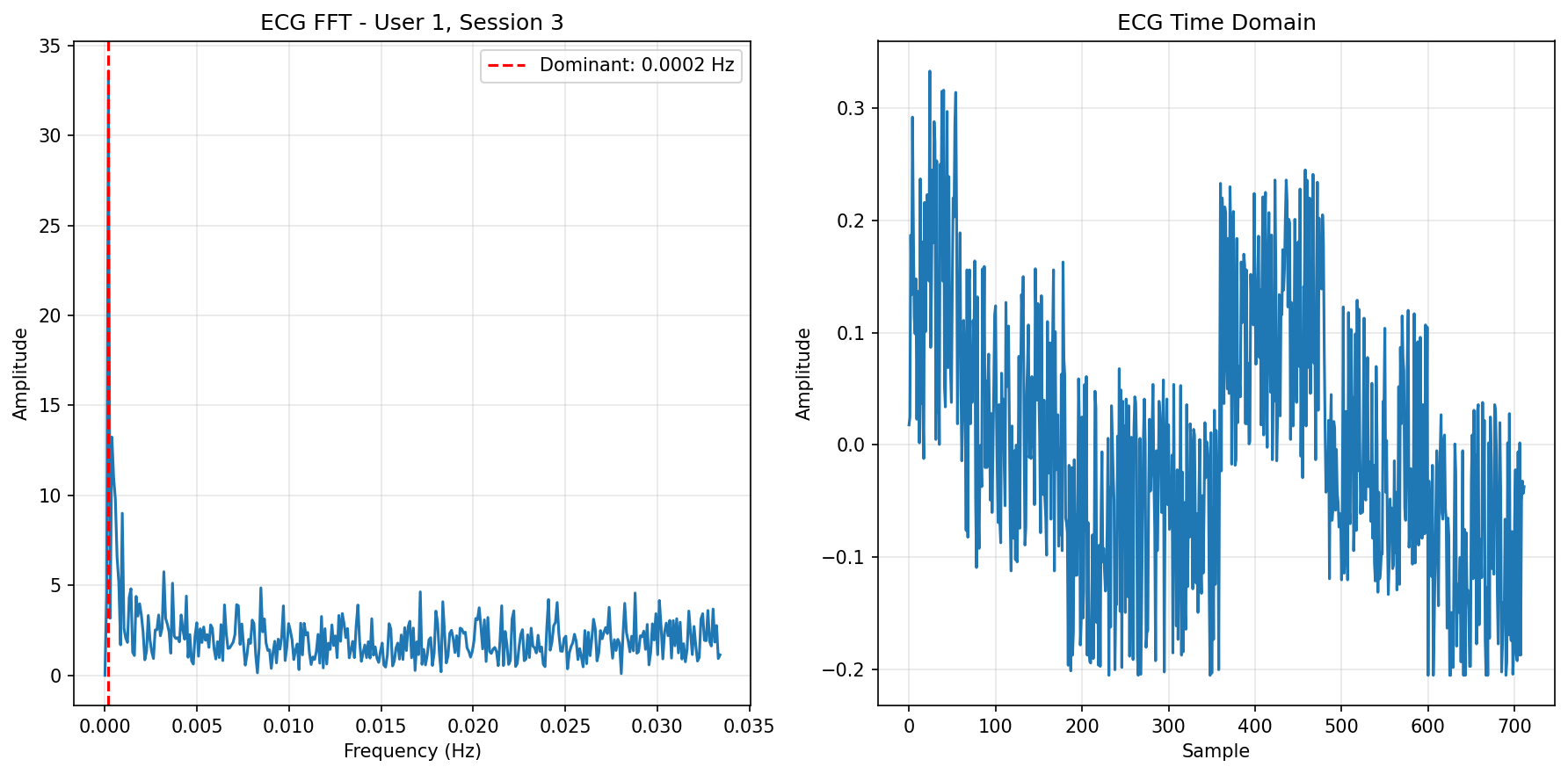 ECG FFT Session 3