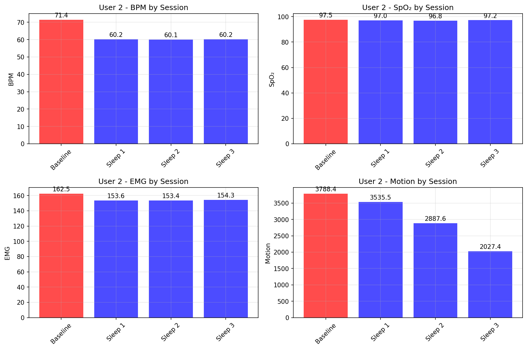 Baseline vs Sessions