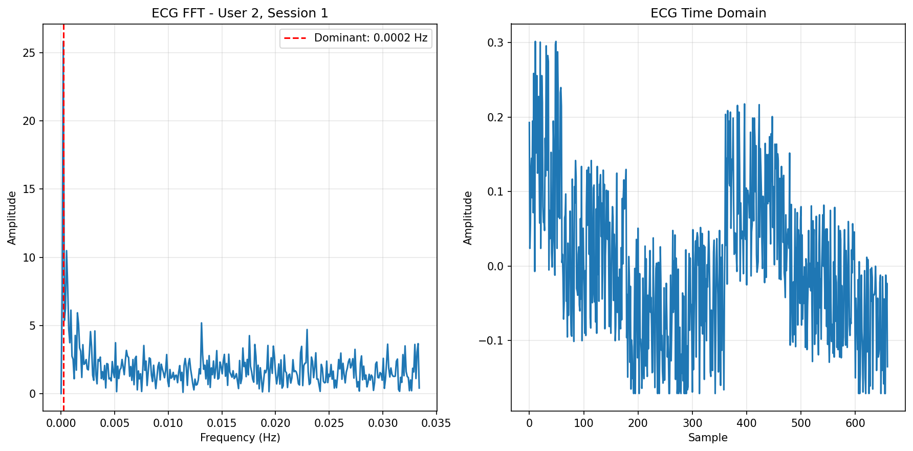 ECG FFT Session 1