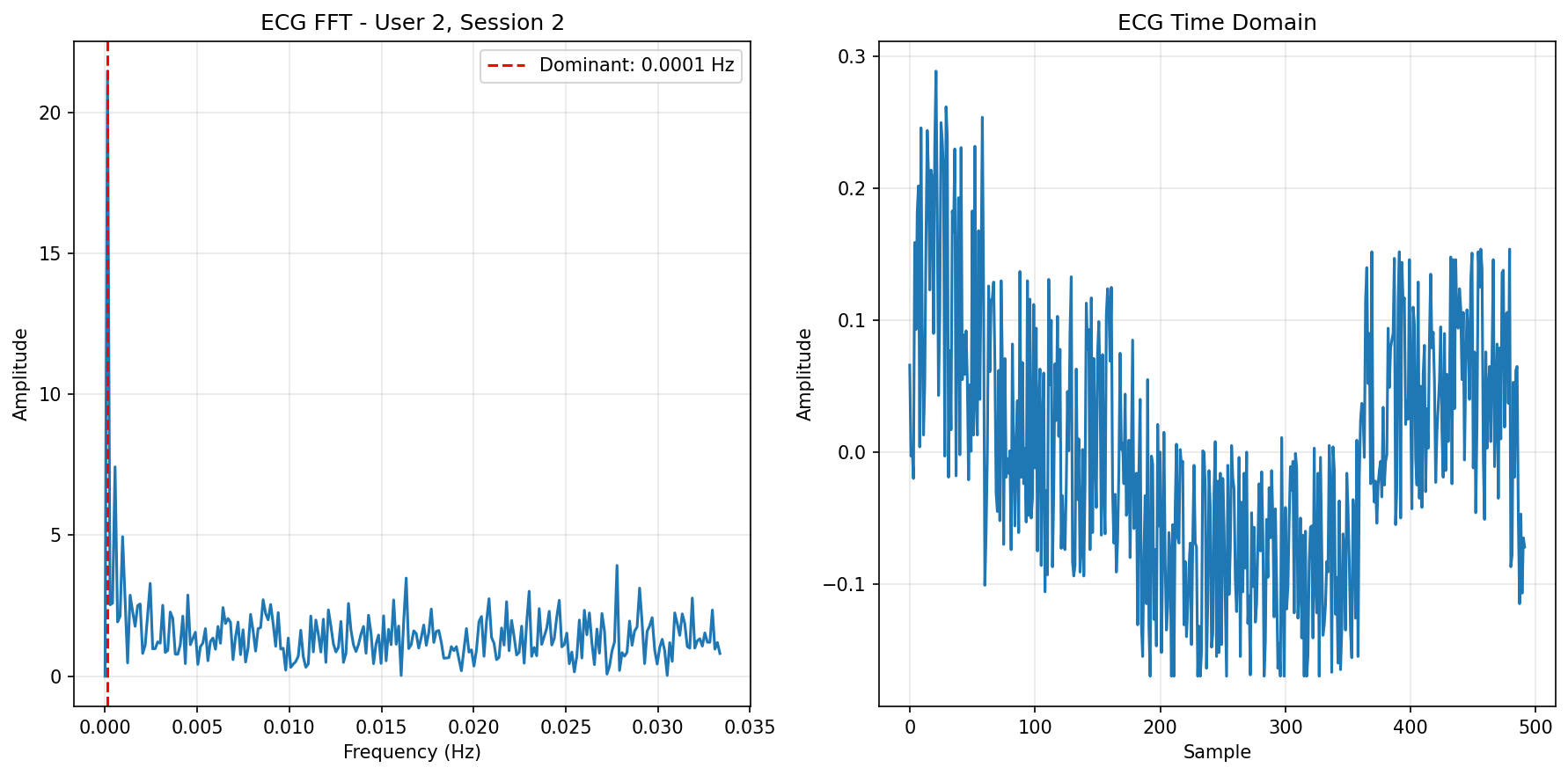 ECG FFT Session 2