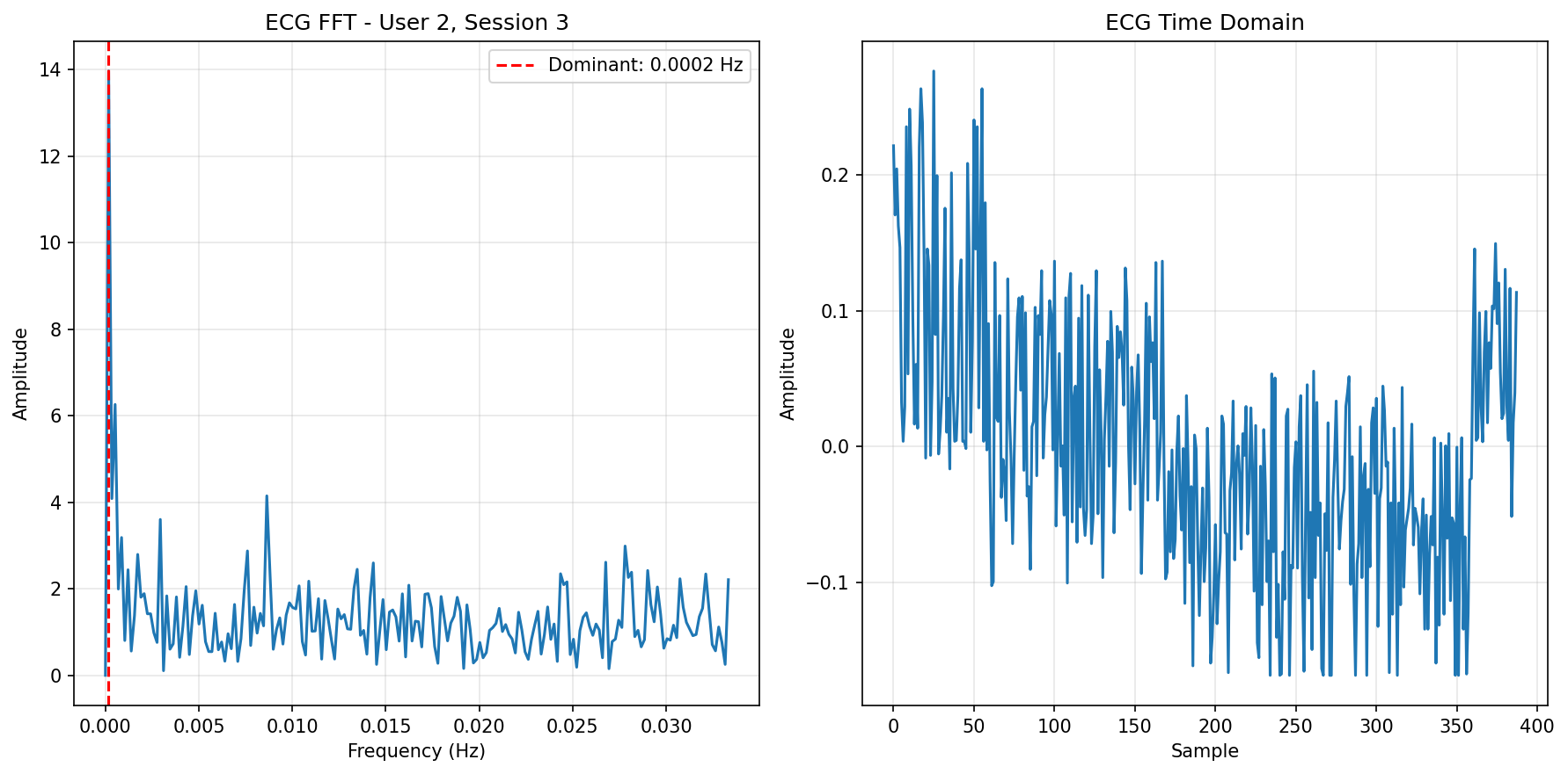 ECG FFT Session 3