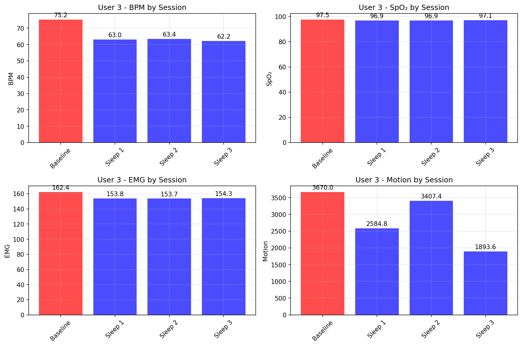 Baseline vs Sessions