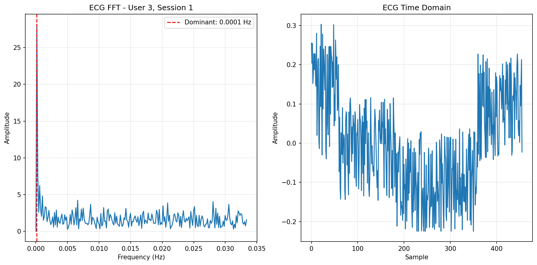 ECG FFT Session 1