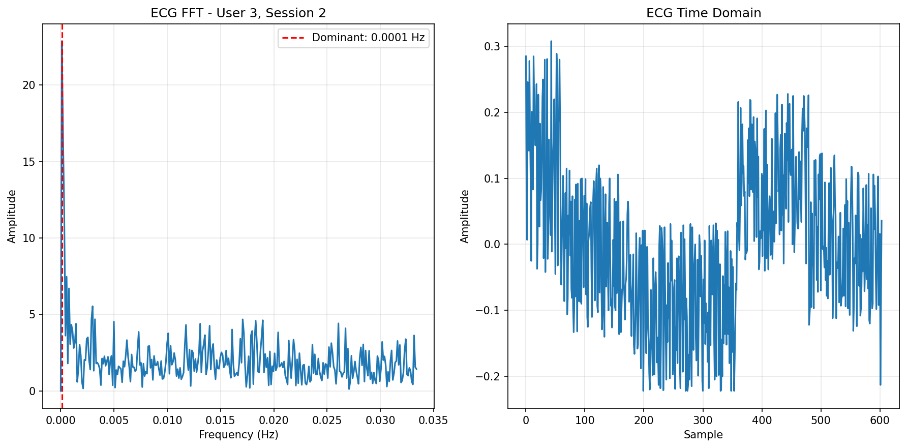 ECG FFT Session 2