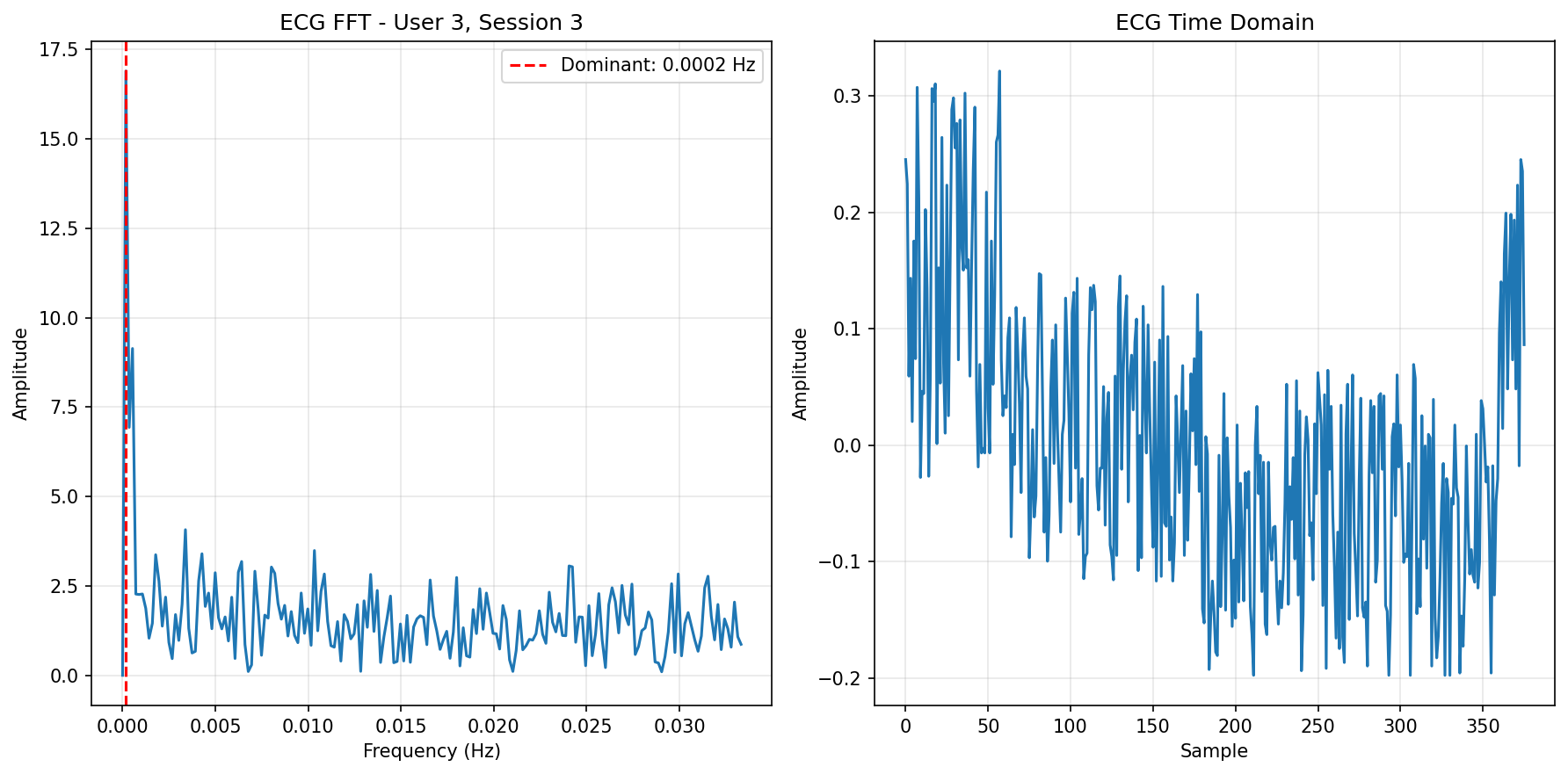 ECG FFT Session 3