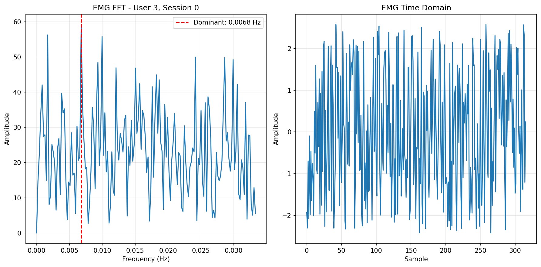 EMG FFT Baseline