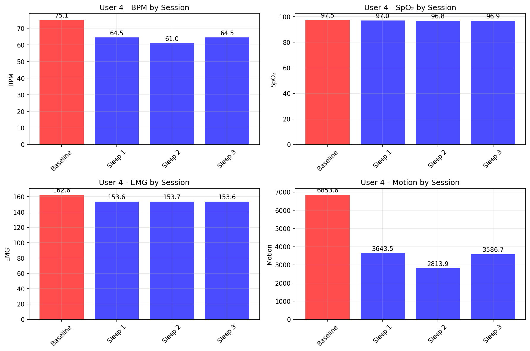 Baseline vs Sessions