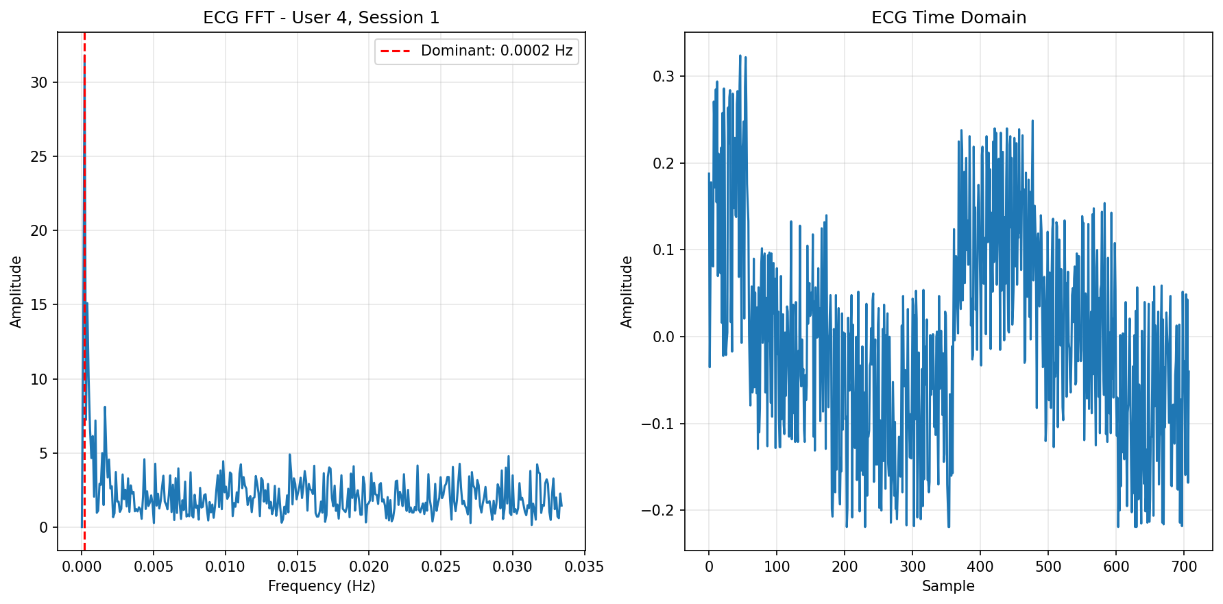 ECG FFT Session 1