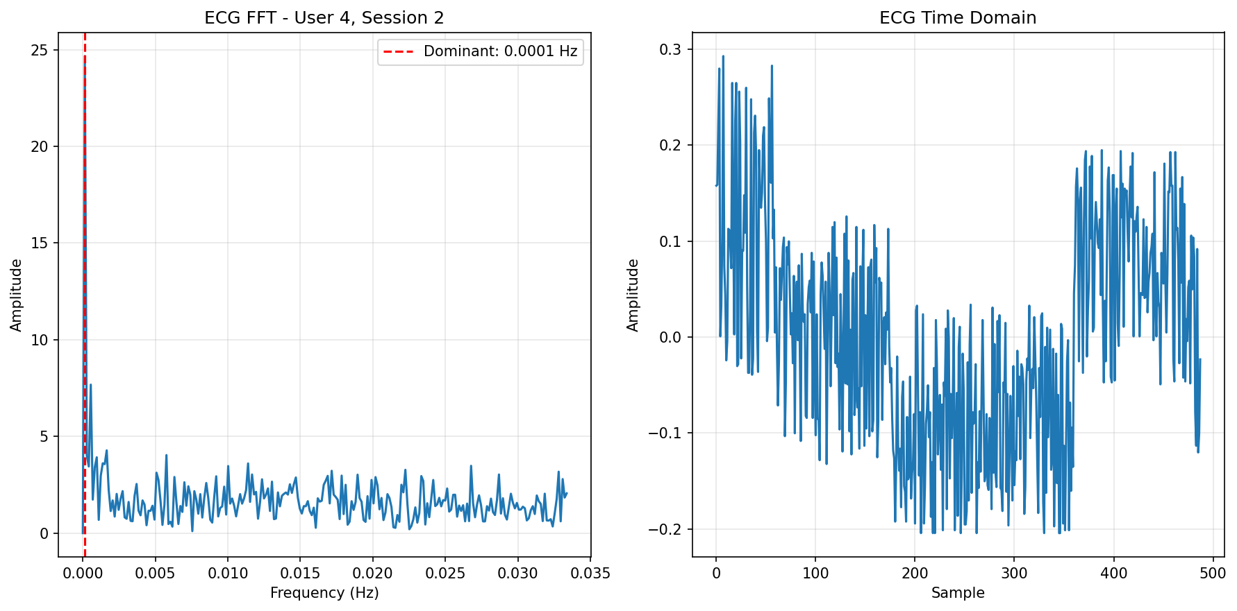 ECG FFT Session 2