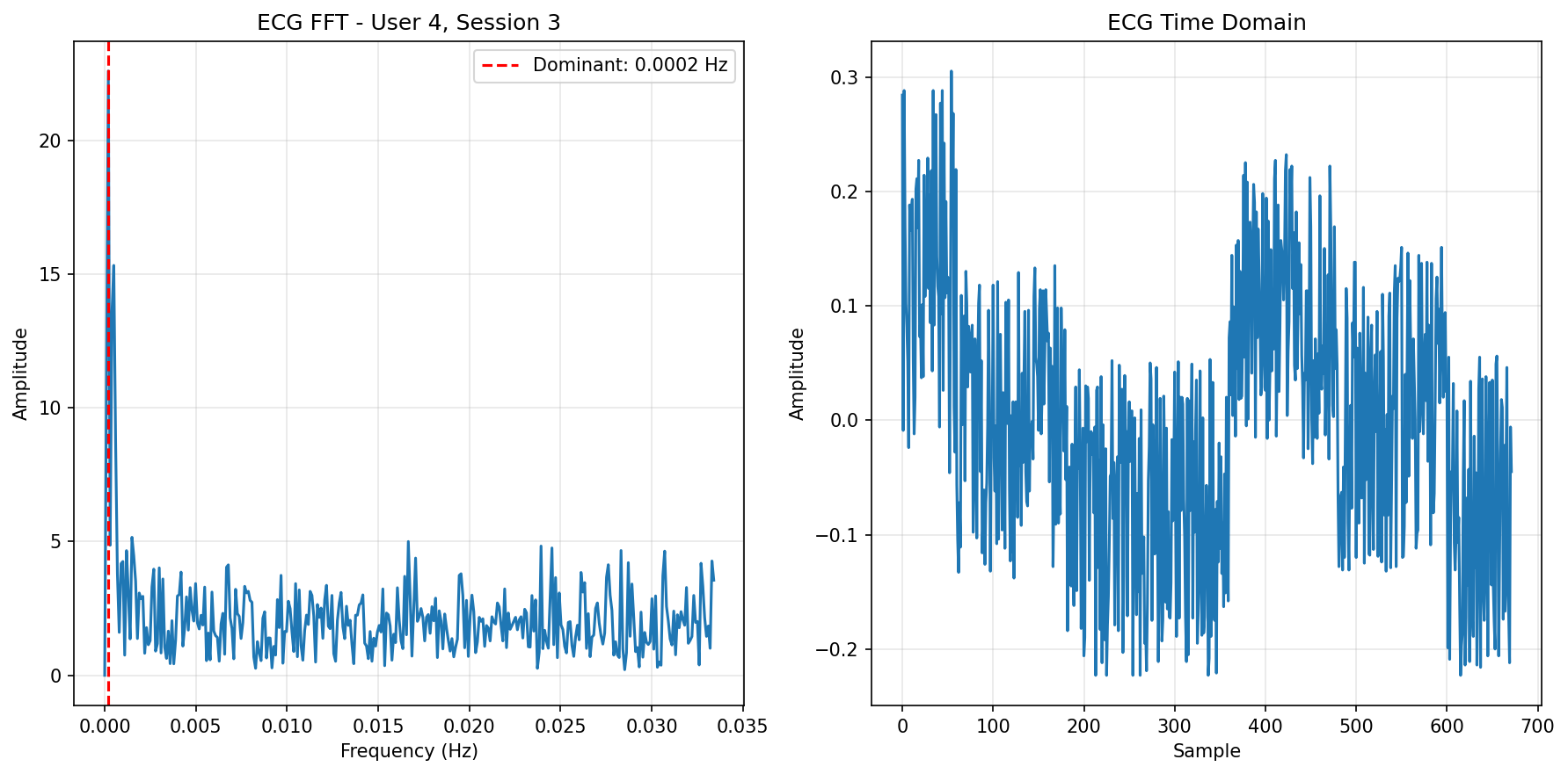 ECG FFT Session 3