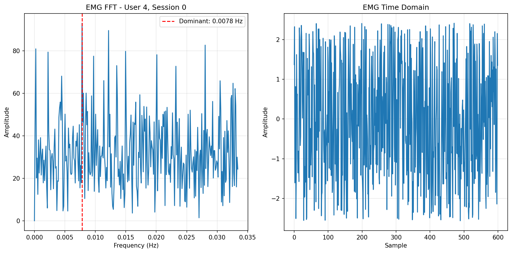 EMG FFT Baseline